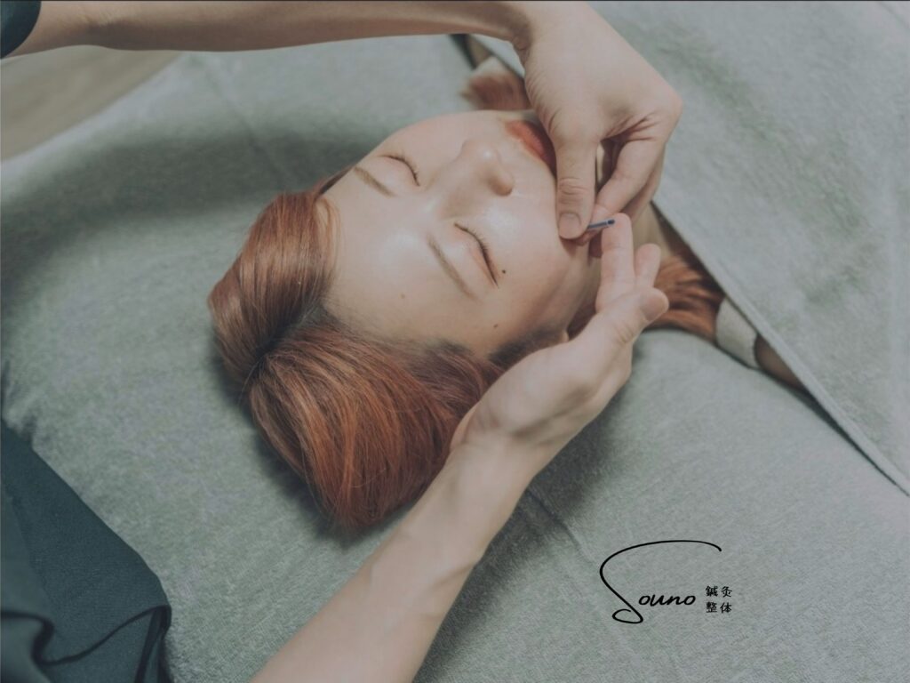 ICCO式美顔はり